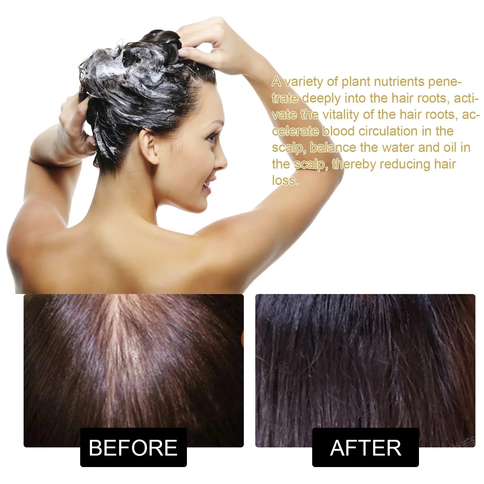 Scalp Treatment Hair Thinning Shampoo